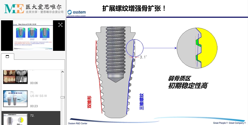 这是我听过最好的奥齿泰口腔种植课程—种植系统介绍哔哩哔哩bilibili
