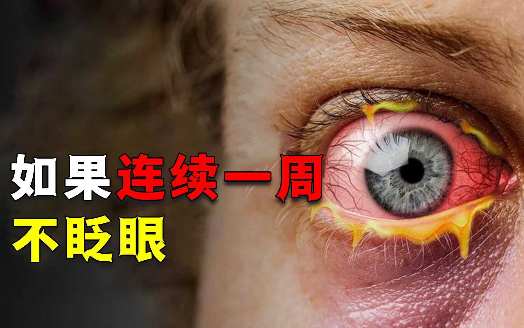 [图]如果连续7天不眨眼，会变成瞎子吗？准备好纸巾一起看到最后