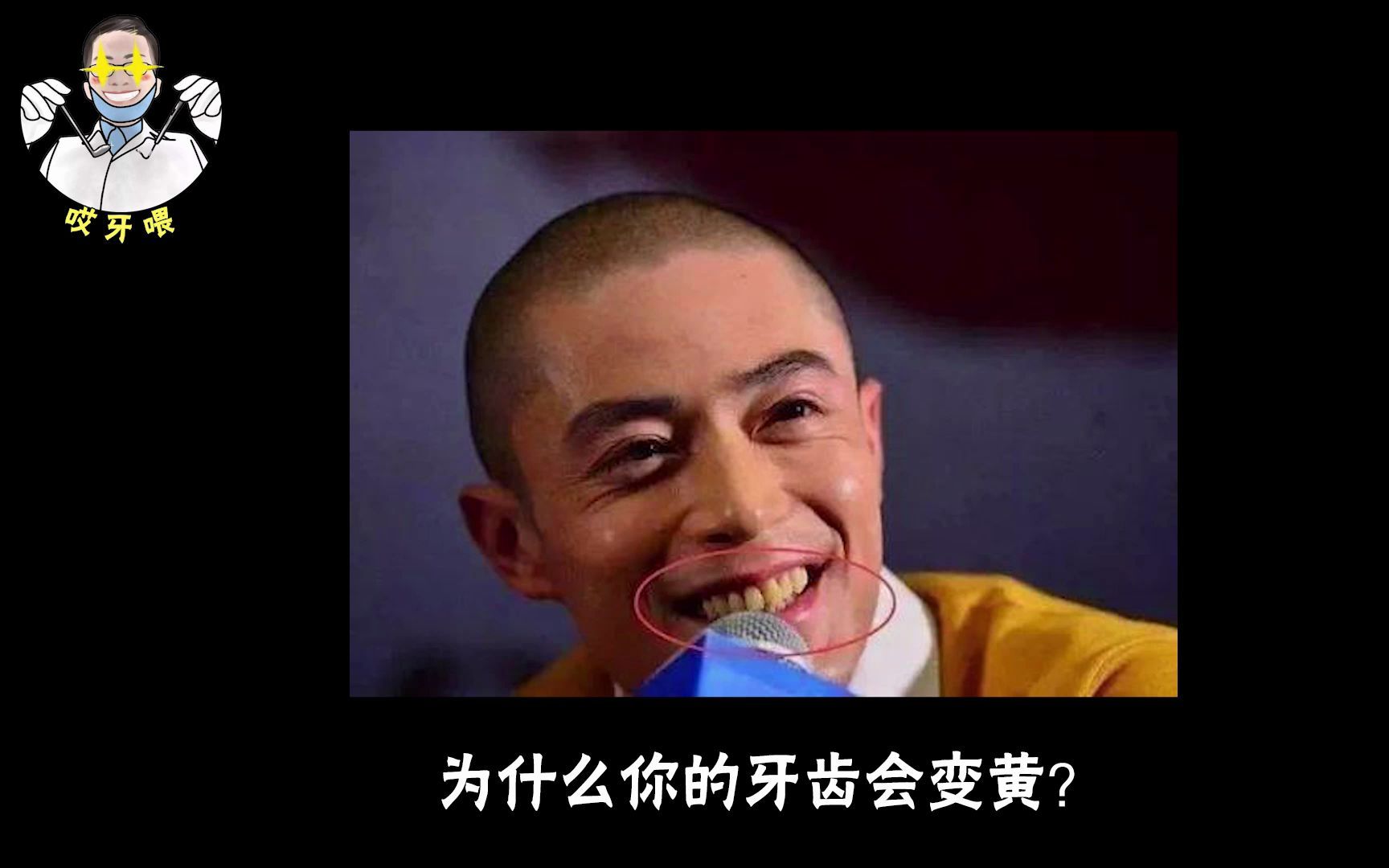 【哎牙喂】为什么你的牙齿会变黄?哔哩哔哩bilibili