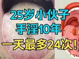 Download Video: 25岁小伙子，手淫10年，一天最多24次，神仙都摇头了！！