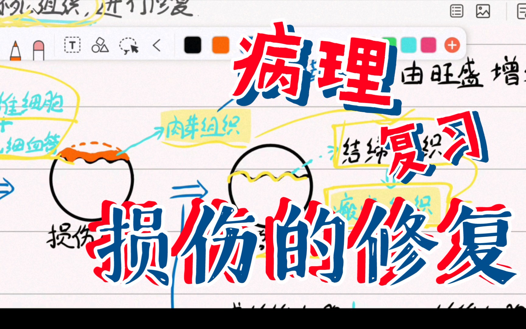 病理学02损伤的修复哔哩哔哩bilibili