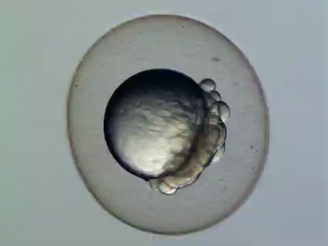 斑马鱼胚胎发育图片