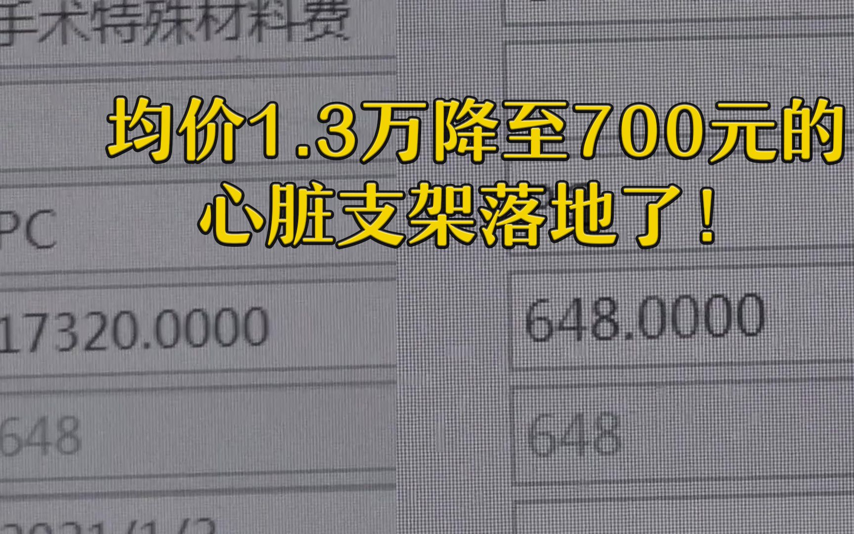 那个均价1.3万降至700元的心脏支架落地了!哔哩哔哩bilibili