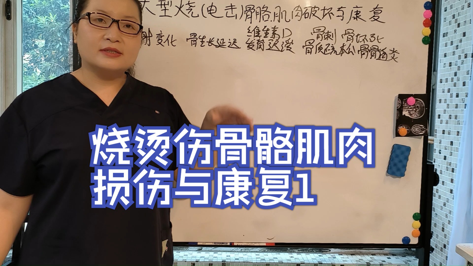 烧烫伤骨骼肌肉损伤与康复1 惠好安康烧伤康复哔哩哔哩bilibili