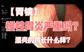 消化道感染 搜索结果 哔哩哔哩 Bilibili