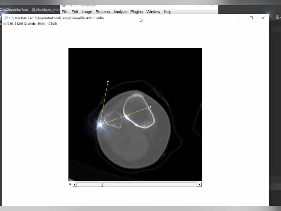 Python Pyqt VTK ITK 医学图像处理 三维重建.专业定制.软件开发哔哩哔哩bilibili