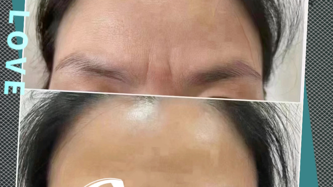 吃土也要做掉川字纹川字纹:斩子剑,风水学讲挡子女运势,有川字纹不仅