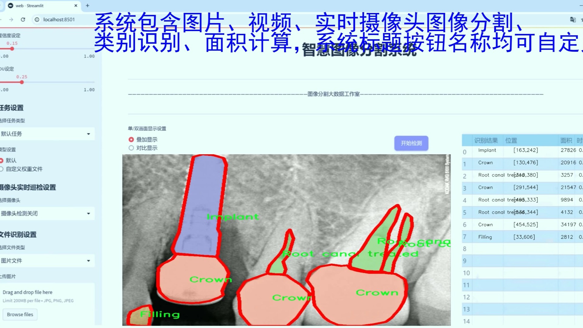 牙片牙齿病变图像分割系统:智能图像检测哔哩哔哩bilibili