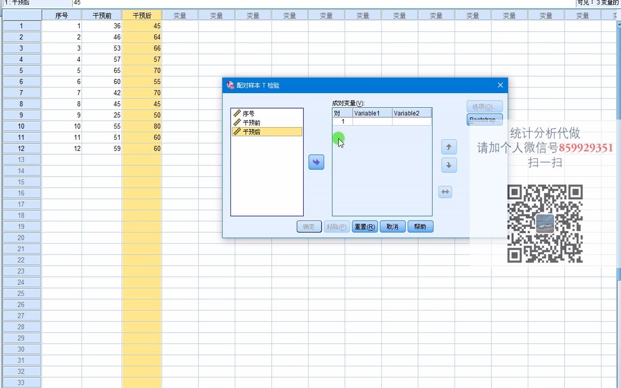 SPSSt检验12两样本配对t检验SPSS医学统计SPSS硕博论文SPSS发表SCI哔哩哔哩bilibili