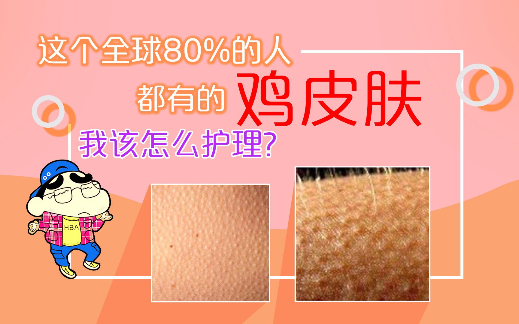 脸红有鸡皮肤是敏感肌吗(脸上突然出现鸡皮肤是过敏么)