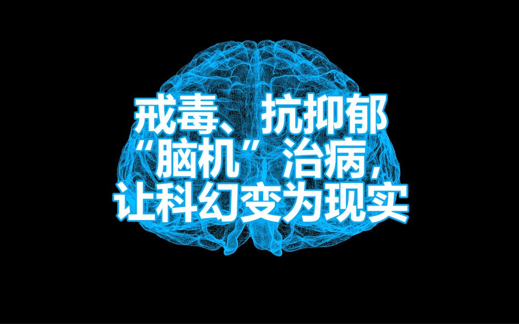 叫板马斯克?这家中国公司将科幻变为现实,用“脑机”治疗疾病哔哩哔哩bilibili