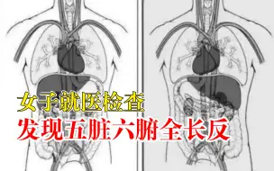 Download Video: 女子就医发现五脏六腑全长反，医生：镜面人，发生率百万分之一