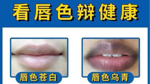 中医教你观唇色知健康 哔哩哔哩