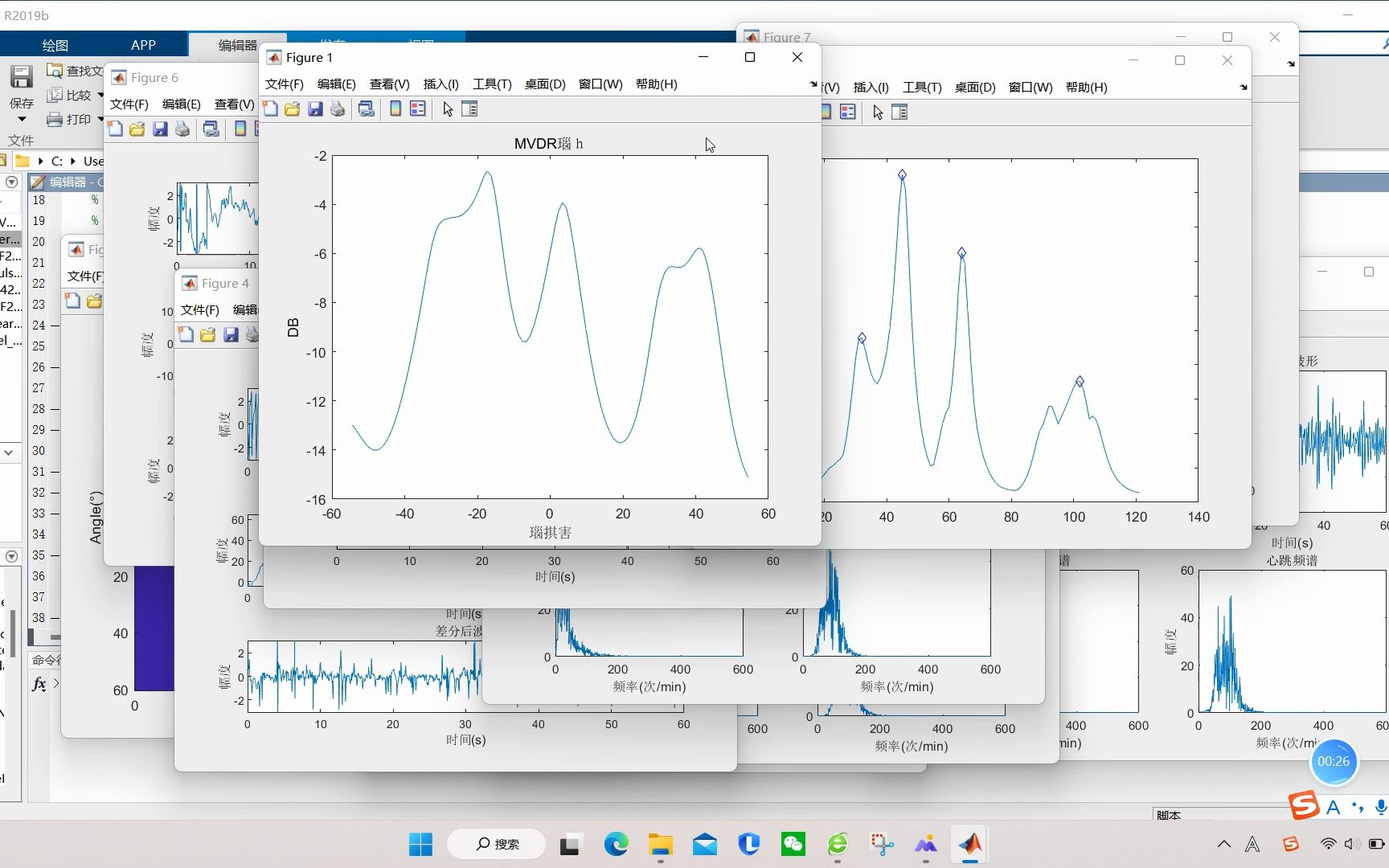 【信号检测】基于matlab MVDR算法多个人体生命体征检测【含Matlab源码 2417期】哔哩哔哩bilibili