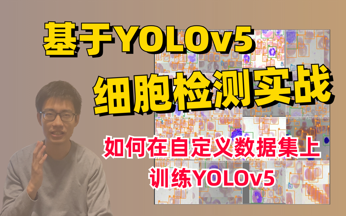 基于YOLOv5的细胞检测实战,迪哥手把手教你如何在自定义数据集上训练YOLOv5哔哩哔哩bilibili