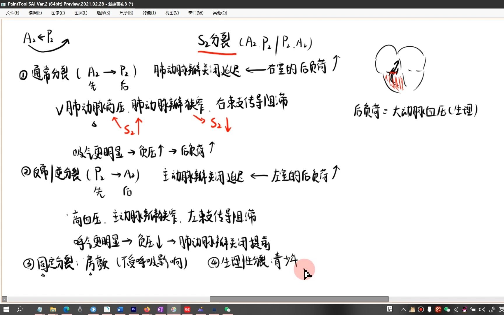 第二心音逆分裂和通常分裂哔哩哔哩bilibili