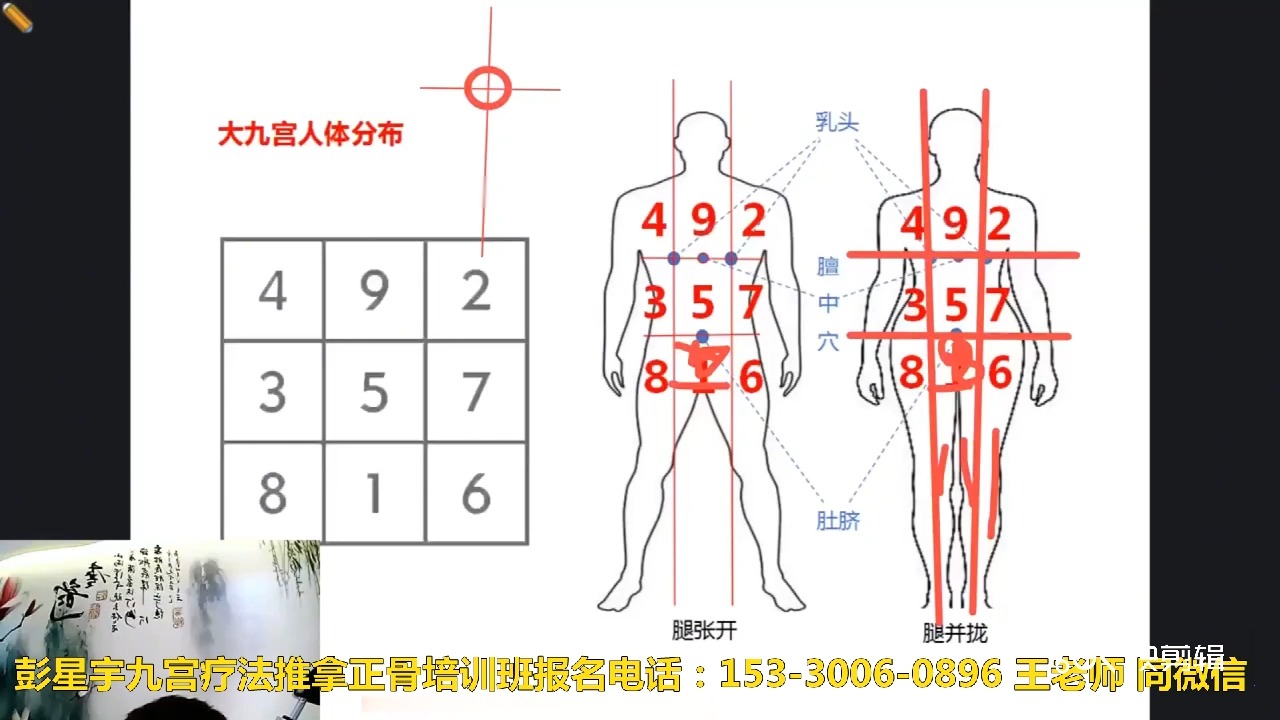 【彭星宇】 古医九宫手法调理坐骨神经痛