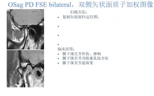 Descargar video: 颞下颌关节的磁共振成像PPT