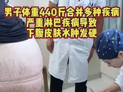 Video herunterladen: 体重440斤，合并多种疾病，下腹皮肤水肿发硬