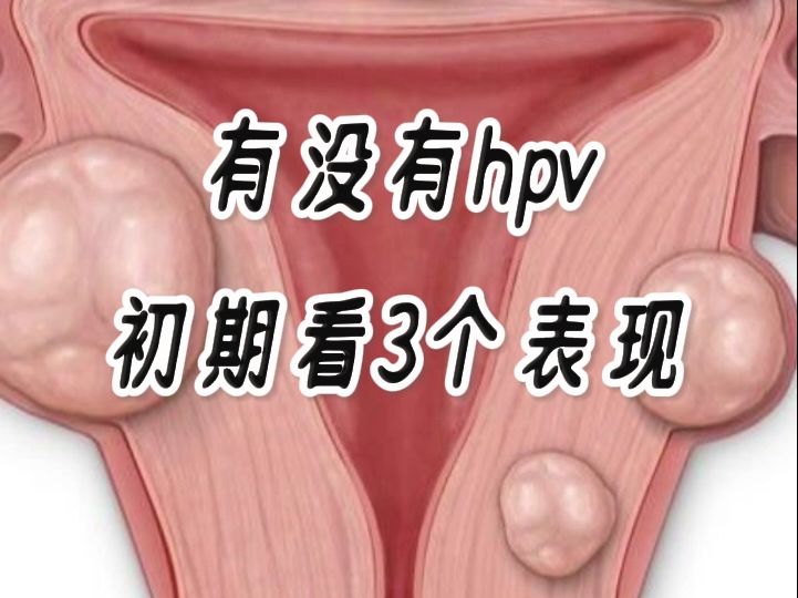 hpv感染初期,3个表现,别忽视