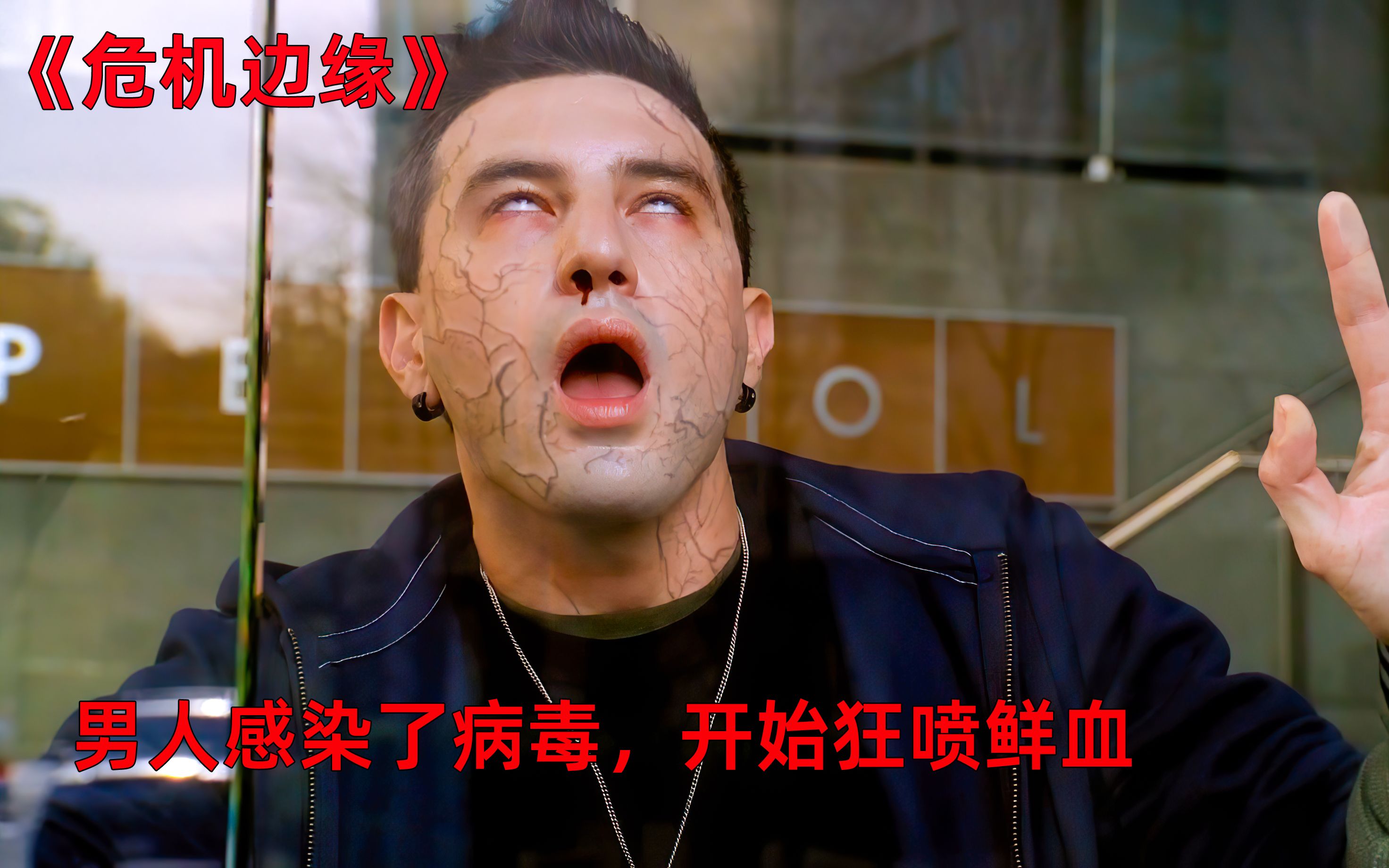 男人因为感染病毒开始口吐鲜血