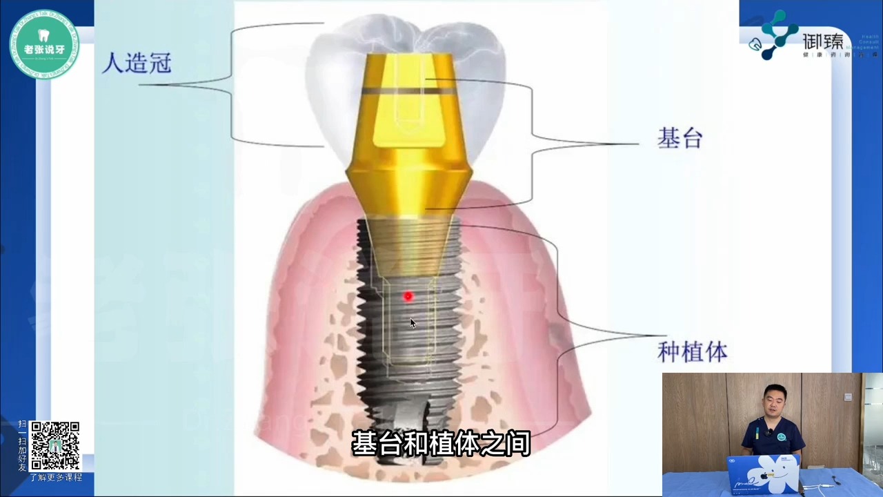 2022张林线上种植课1.2 现代口腔种植技术与三个阶段哔哩哔哩bilibili