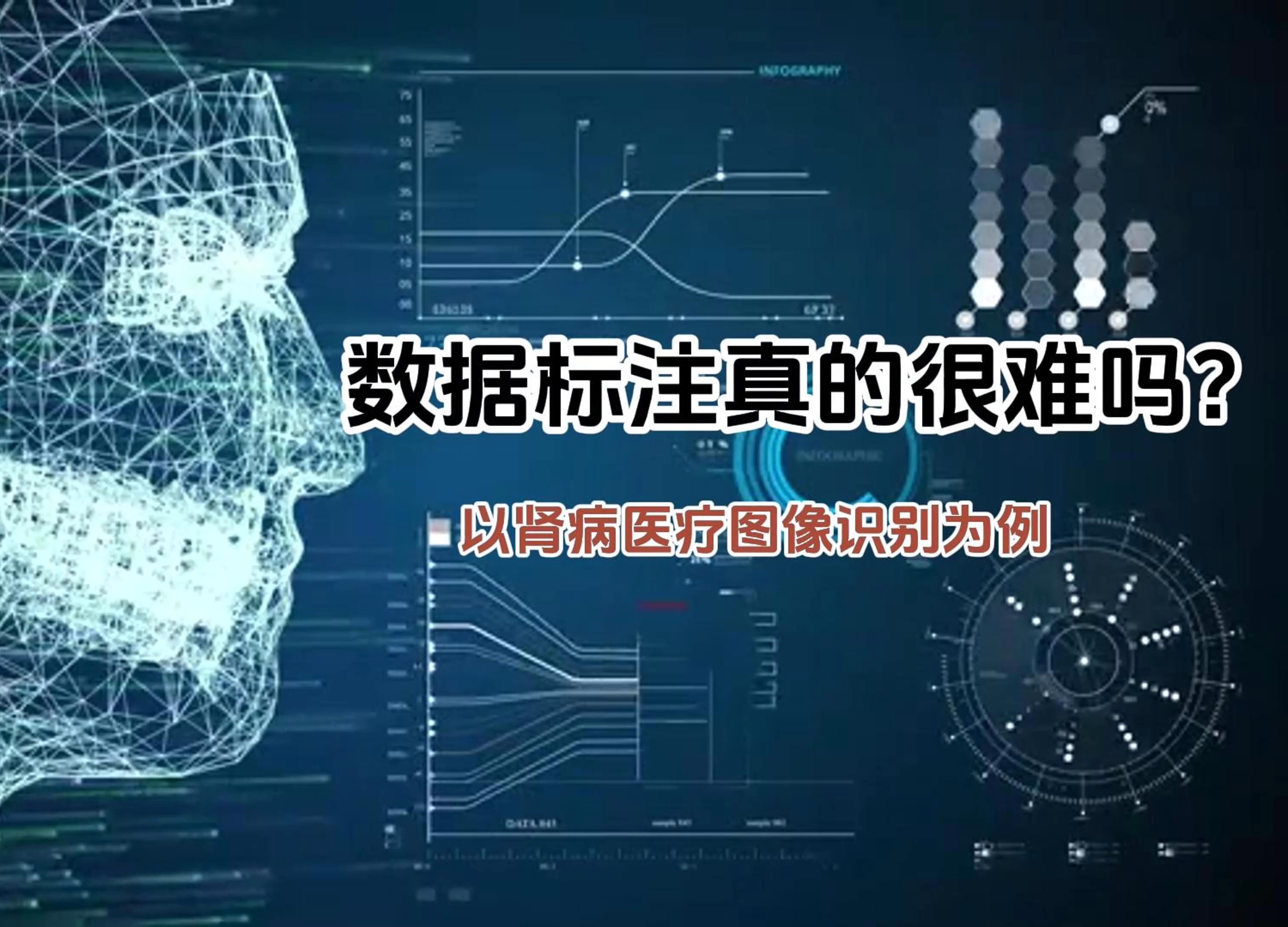 揭秘医疗ai:肾病图像识别背后的数据标注难题
