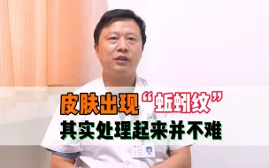 Télécharger la video: 大腿或臀部出现“蚯蚓”条纹，其实处理起来并不难