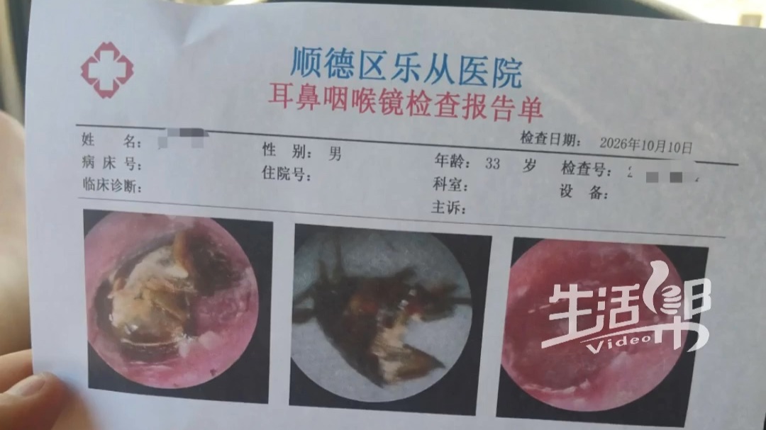广东33岁男子睡梦中蟑螂钻进耳道 当事人：蟑螂死在耳朵里近一周 左耳耳膜险穿孔 听力受影响 耳朵进虫 滴水或油后快就医
