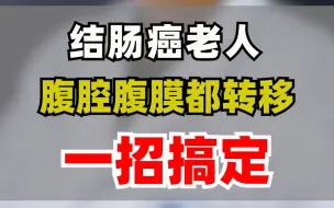 下载视频: 结肠癌老人，腹腔腹膜都转移，一招搞定