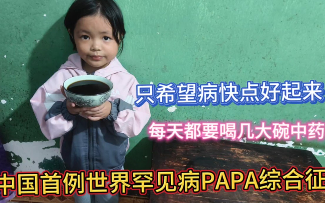 中国首例世界罕见病PAPA综合征馨馨患病7年多,馨馨每天喝几大碗药,只希望病快点好起来哔哩哔哩bilibili