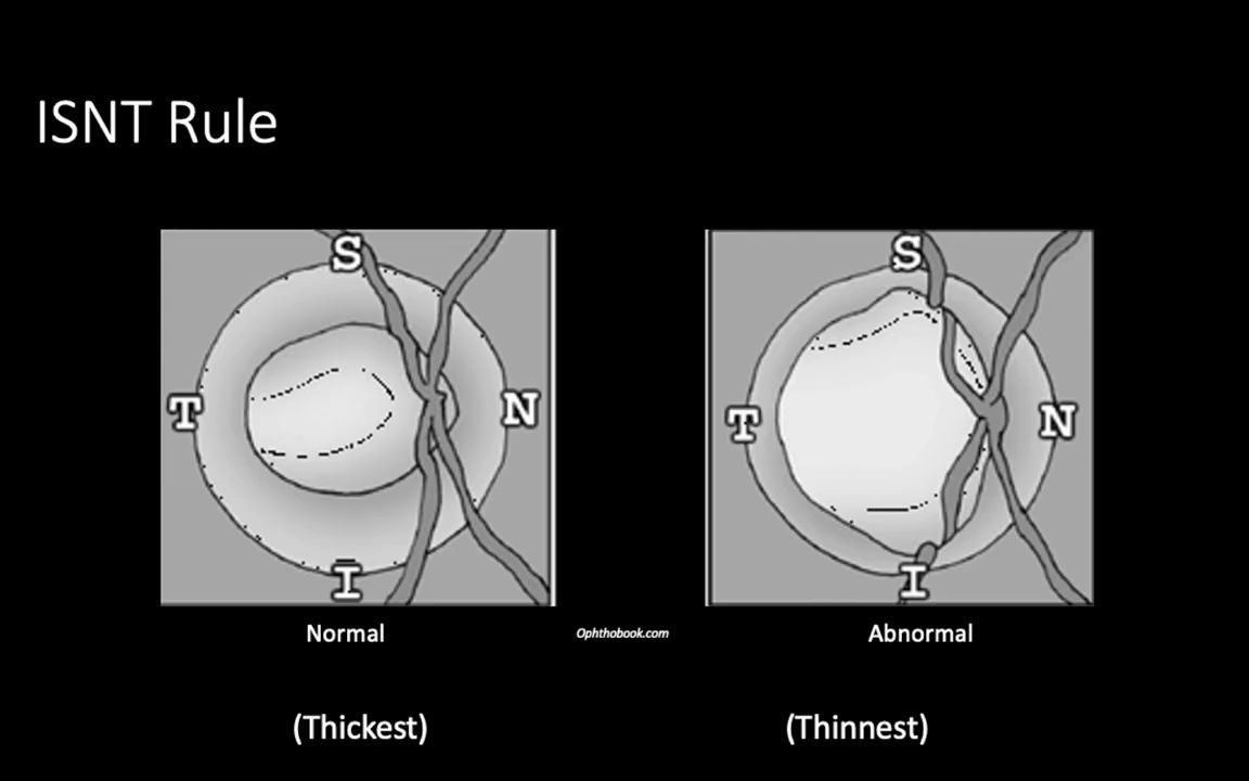 [图]Fundus Photography Interpretation-眼底照读片