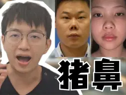 Download Video: 猪鼻子不再是你的标签，详述解决的原理！