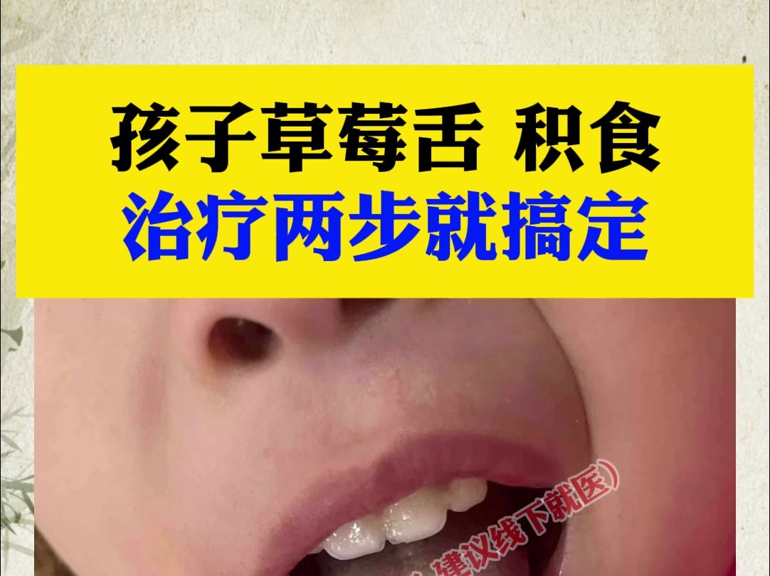 孩子草莓舌 积食,中医两步治疗哔哩哔哩bilibili