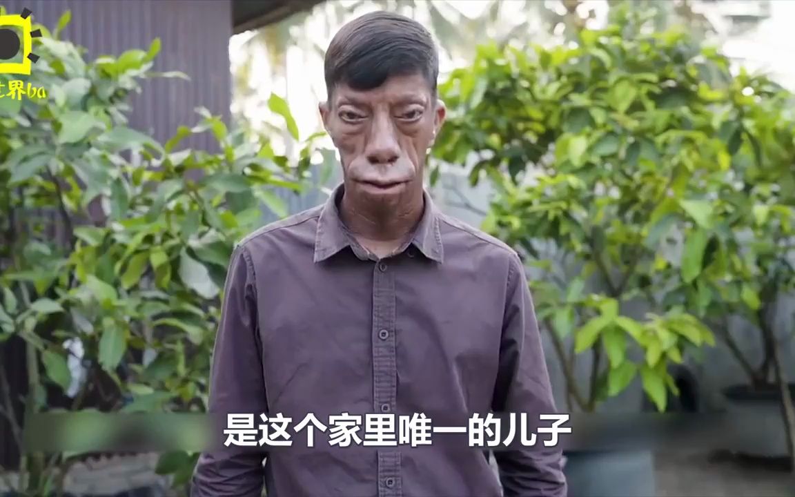 纪录片:印尼家族遭遇罕见"怪病",兄妹6个,4个"变脸"