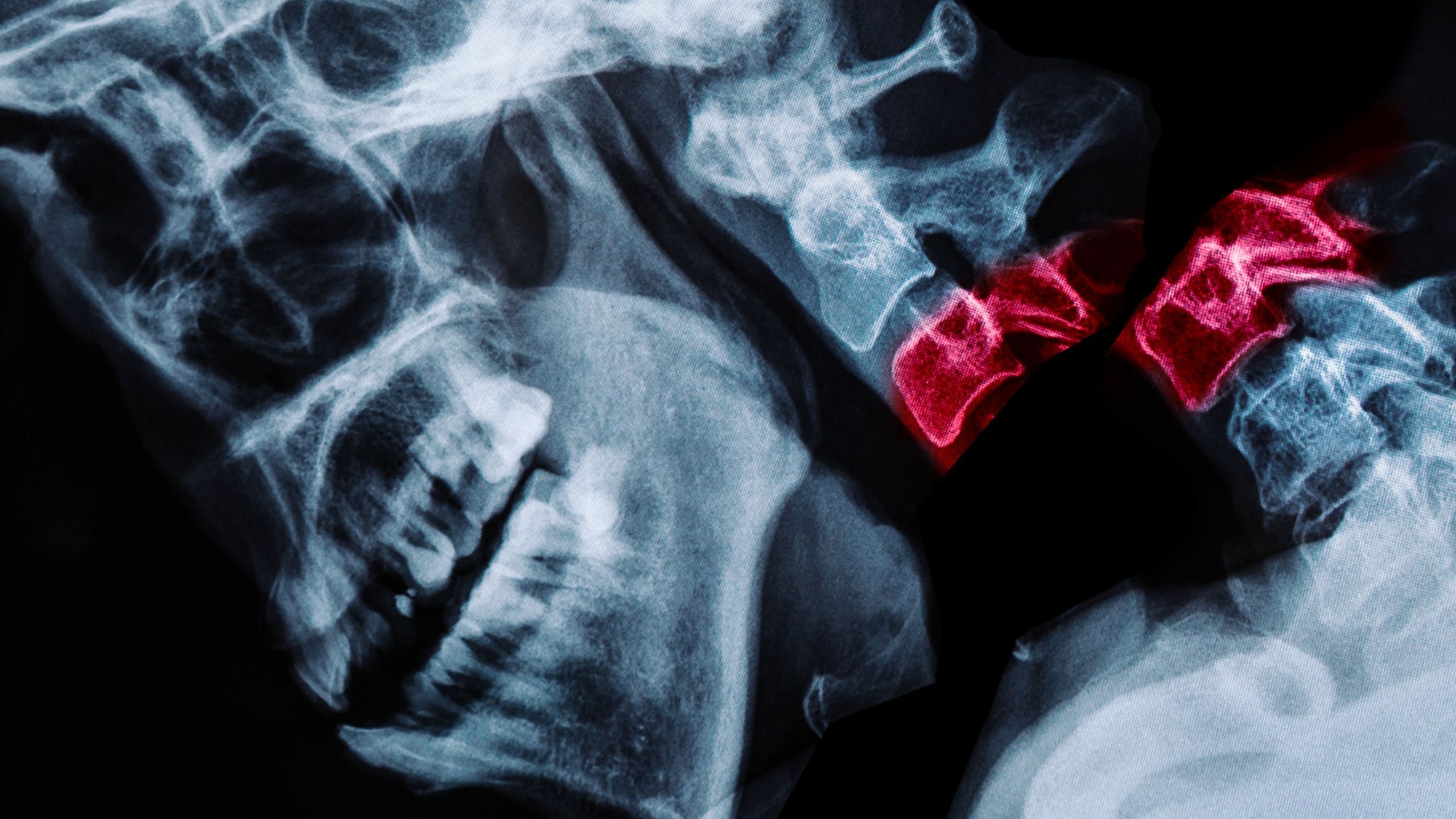 一位母亲对自己的脖子进行了脊椎按摩治疗，这是她的大脑发生的变化