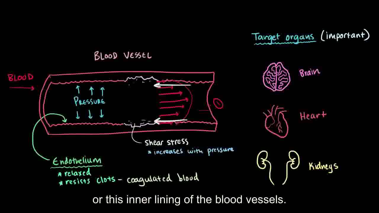 [图]【搬运KhanAcademy】循环系统疾病——Hypertension and blood vessel damage