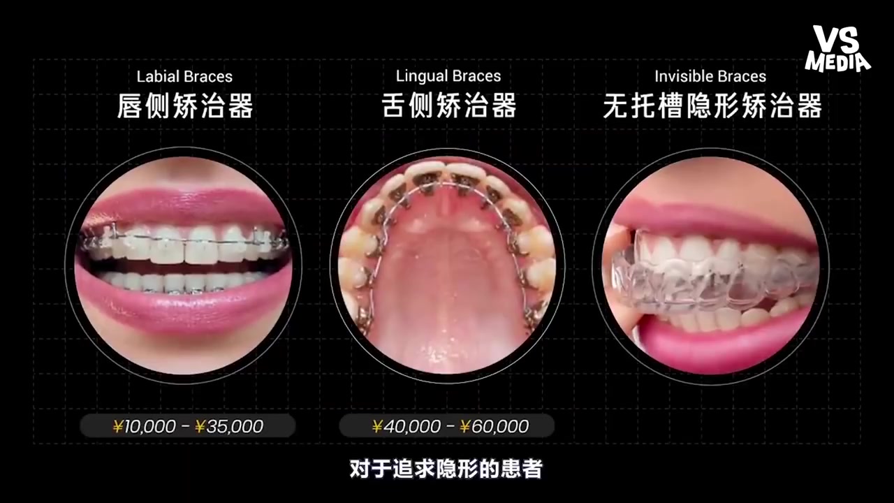 [图]科學整牙方法大揭密！ 看完覺得牙齒都痛了...《VS MEDIA》