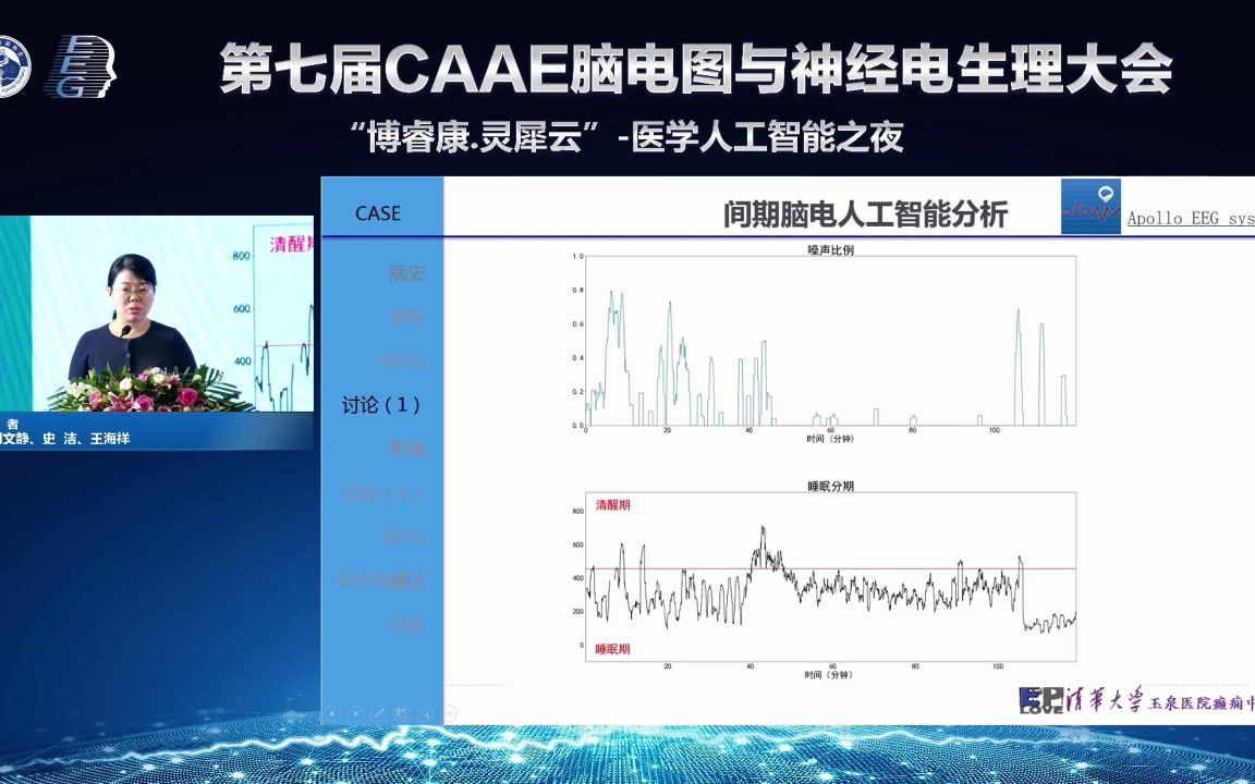 [图]AI在癫痫诊疗领域的应用