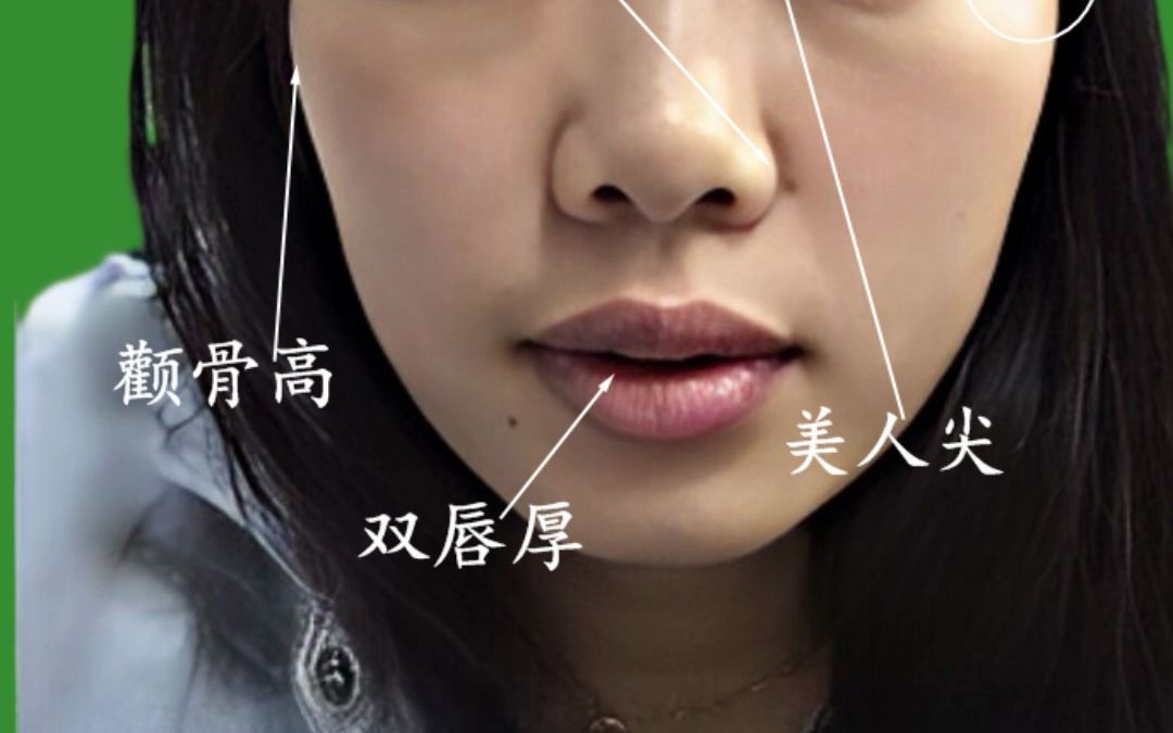 女人面相的"妒忌痣"