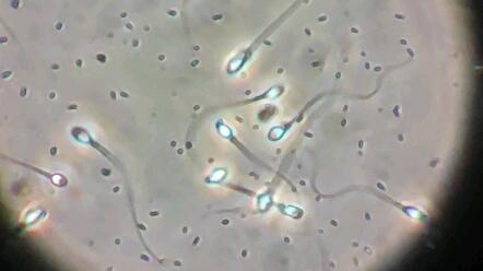 显微镜下观察精液中的精子_哔哩哔哩_bilibili