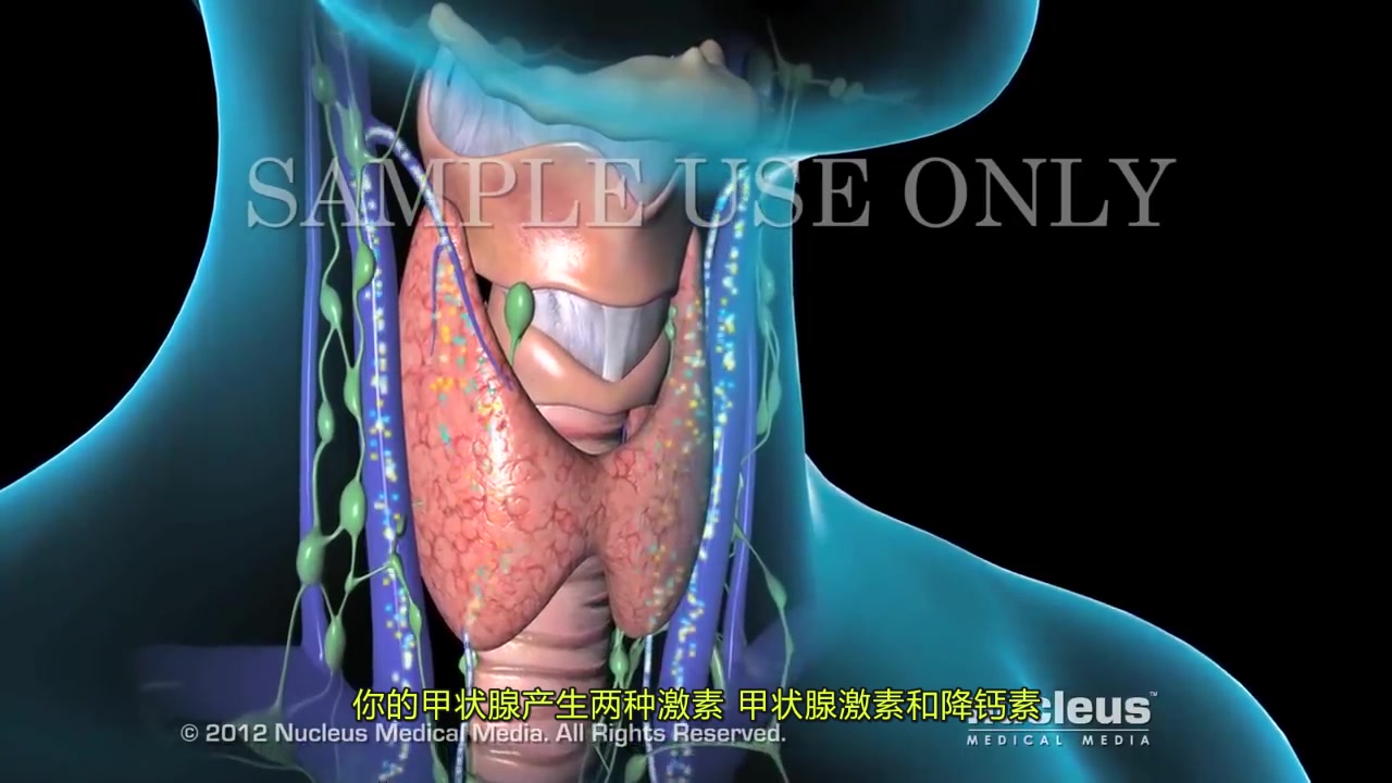 [图]【3D医学动画】甲状腺癌