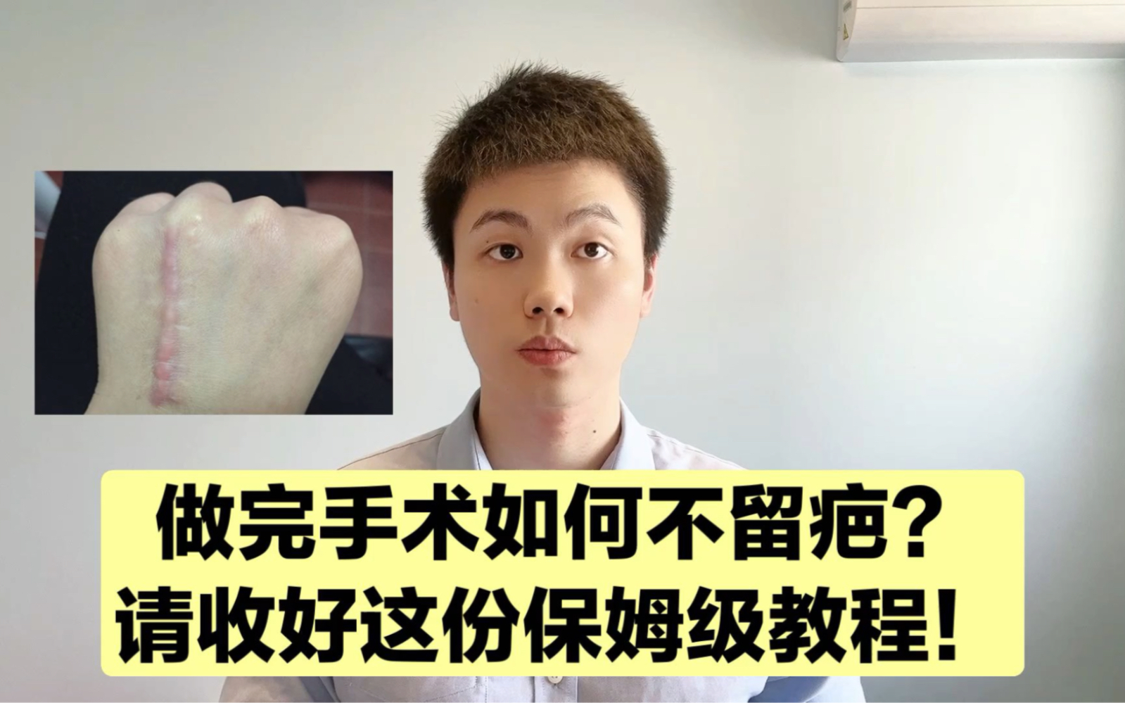 [图]术后如何不留疤？怎么淡化疤痕？很多医生也是一知半解，请收下这份超详细的攻略！