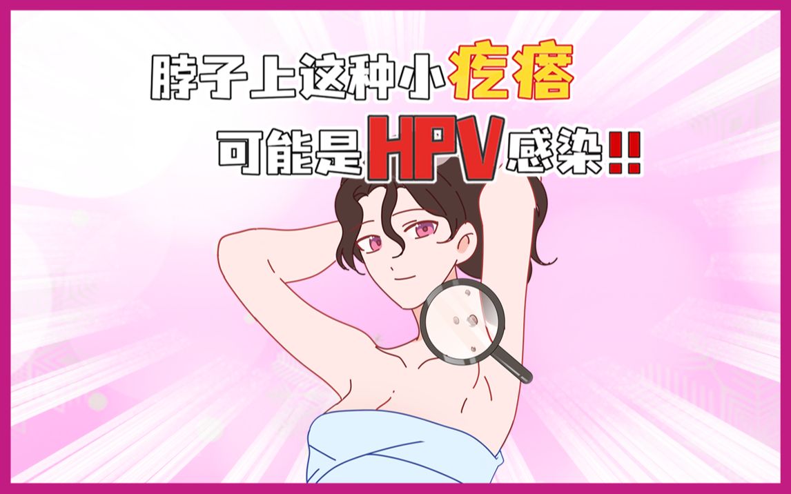 脖子上这种小疙瘩千万别抠,当心是hpv感染!哔哩哔哩bilibili