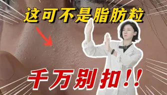 Tải video: 这可不是脂肪粒，千万别扣！