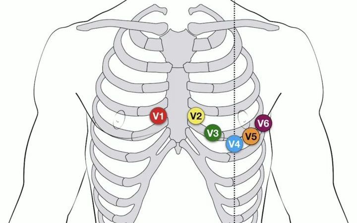 肢体导联和胸导联图片