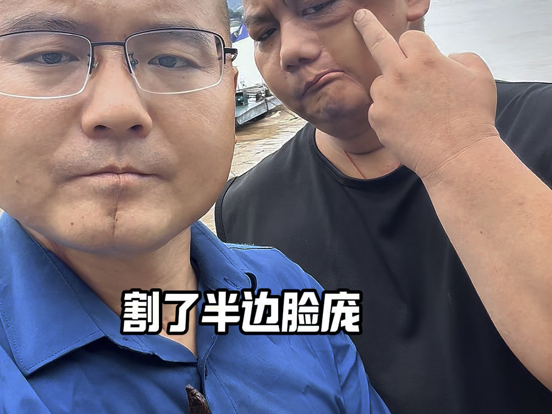 男的吃槟榔是干嘛用的为什么在线 男的吃槟榔是干嘛用的为什么在线