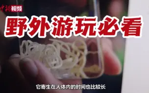 Télécharger la video: 网传“龙线虫”可怕吗？专家为你送上野外防避毒虫小妙招