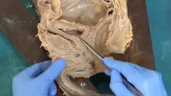 男性的尿道几乎有20厘米长，这个长度和阴茎有直接关系