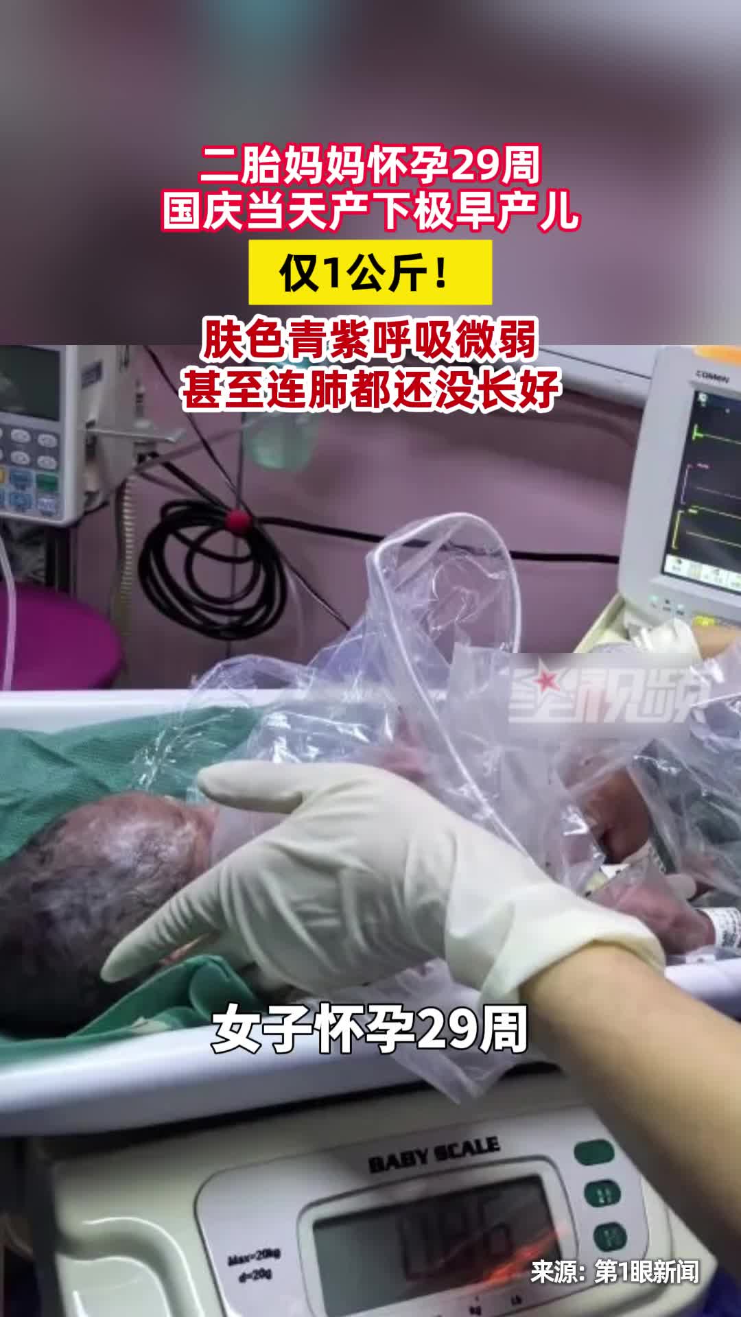 二胎妈妈怀孕29周，国庆当天产下极早产儿，仅1公斤！